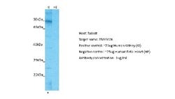 TMEM26 Rabbit anti-Human, Polyclonal, Novus Biologicals 0.1 mL | Buy Online | Novus Biologicals | Fisher Scientific